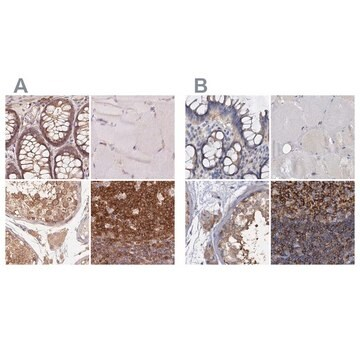 Anti-ANKRD13A antibody produced in rabbit, 100 µL (HPA043218-100UL)