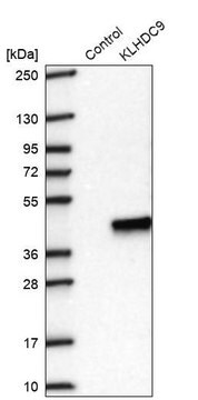 Anti-KLHDC9 antibody produced in rabbit, 100 µL (HPA043197-100UL)