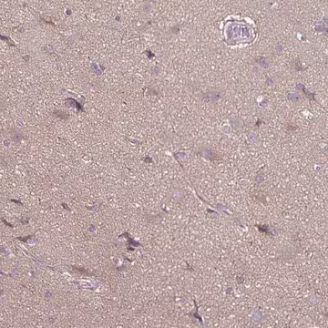 Anti-FSD1 antibody produced in rabbit, 1 X 100 µL (HPA043141-100UL)