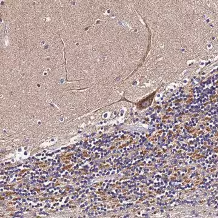 Anti-ZNF573 antibody produced in rabbit, 1 X 100 µL (HPA042776-100UL)