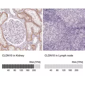 Anti-CLDN10 antibody produced in rabbit, 100 µL (HPA042348-100UL)