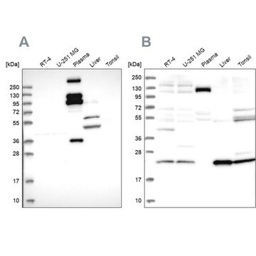 Anti-REXO1 antibody produced in rabbit, 1 X 100 µL (HPA042155-100UL)