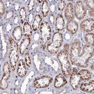 Anti-NUDT7 antibody produced in rabbit, 1 X 100 µL (HPA042042-100UL)