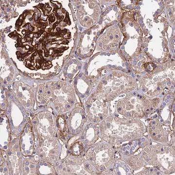 Anti-EVA1B antibody produced in rabbit, 1 X 100 µL (HPA041928-100UL)