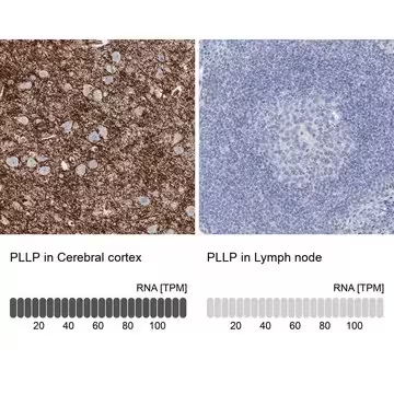 Anti-PLLP antibody produced in rabbit, 1 X 100 µL (HPA041862-100UL)