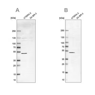 Anti-IST1 antibody produced in rabbit, 1 X 100 µL (HPA041802-100UL)