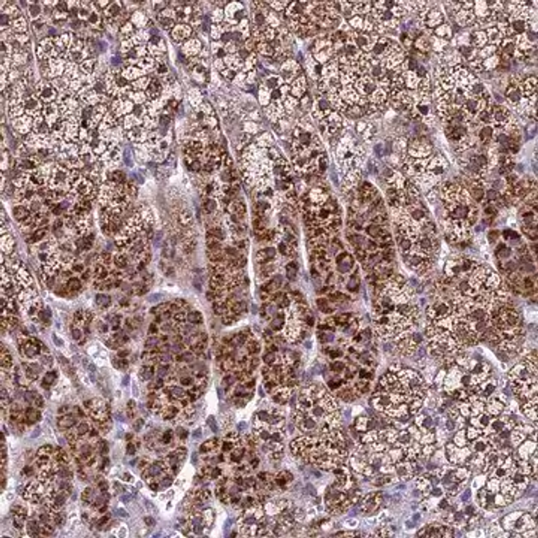 Anti-CARS2 antibody produced in rabbit, 1 X 100 µL (HPA041776-100UL)