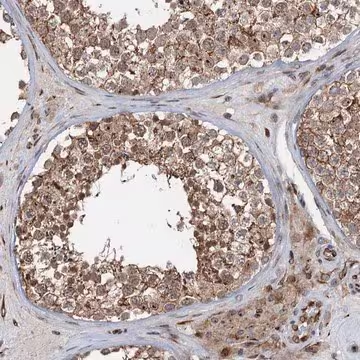 Anti-TMA16 antibody produced in rabbit, 1 X 100 µL (HPA041571-100UL)