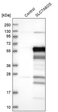 Anti-SLC7A6OS antibody produced in rabbit, 1 X 100 µL (HPA041533-100UL)