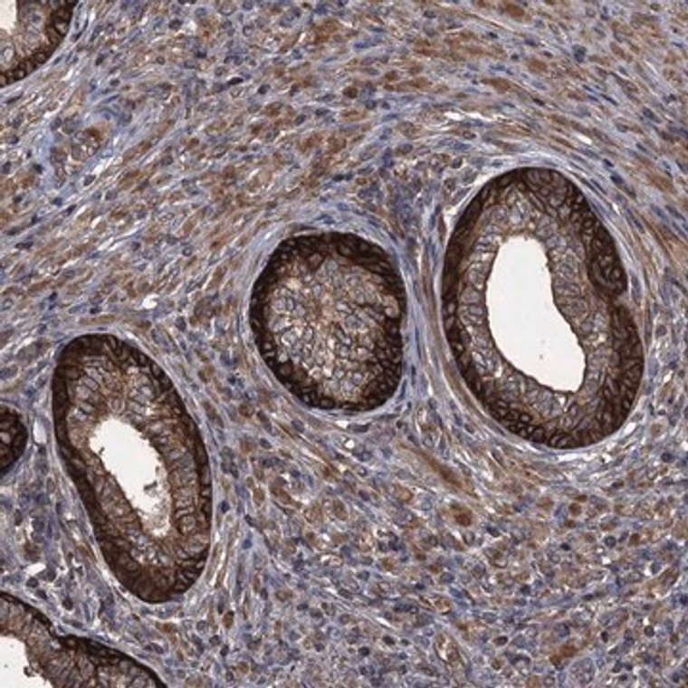 Anti-TXNDC11 antibody produced in rabbit, 1 X 100 µL (HPA041174-100UL)