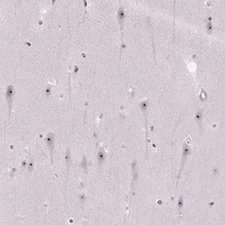 Anti-UTP4 antibody produced in rabbit, 1 X 100 µL (HPA041139-100UL)