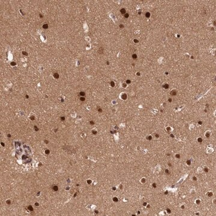 Anti-ADIG antibody produced in rabbit, 1 X 100 µL (HPA041124-100UL)