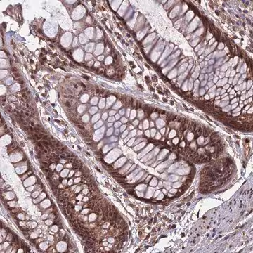 Anti-SPG11 antibody produced in rabbit, 1 X 100 µL (HPA040947-100UL)
