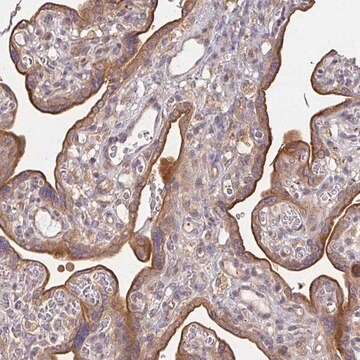 Anti-EEF1AKMT1 antibody produced in rabbit, 1 X 100 µL (HPA040417-100UL)