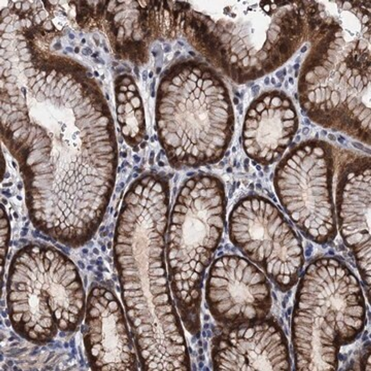 Anti-FAM222A antibody produced in rabbit, 1 X 100 µL (HPA040181-100UL)