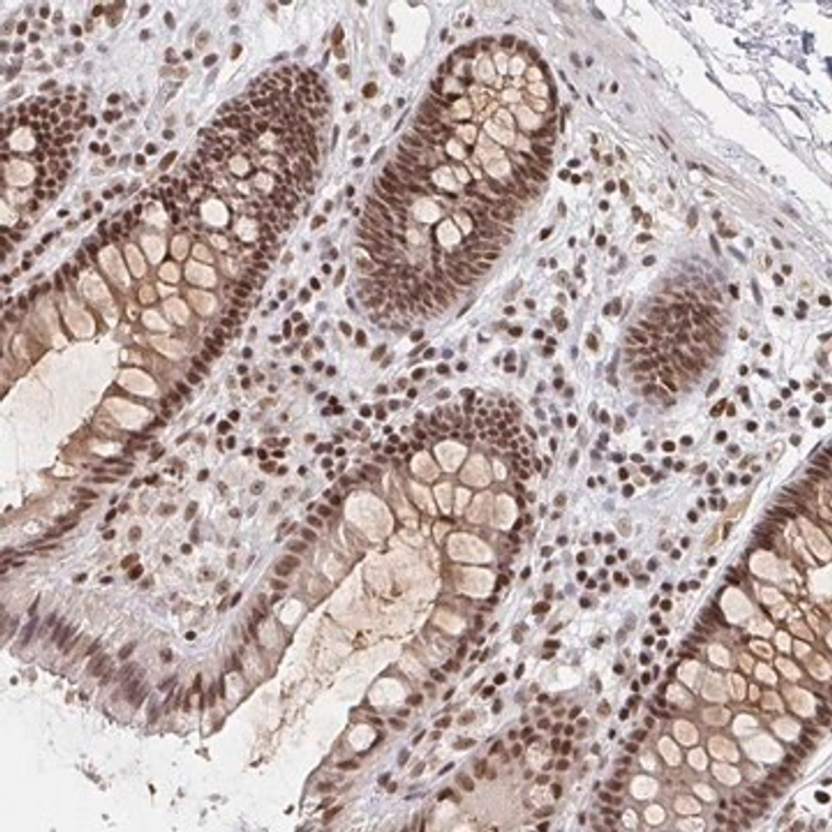 Anti-H1FX antibody produced in rabbit, 1 X 100 µL (HPA040099-100UL)