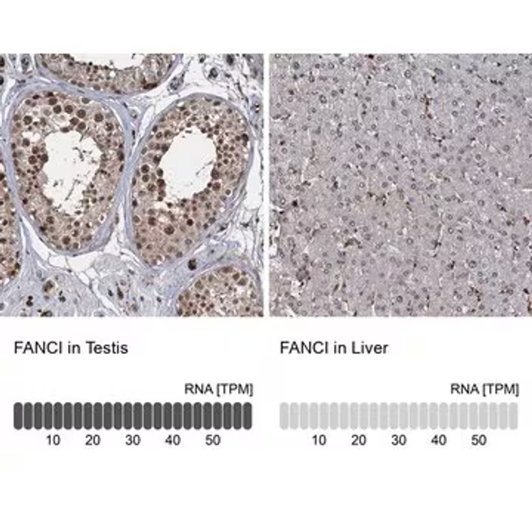 Anti-FANCI antibody produced in rabbit, 1 X 100 µL (HPA039972-100UL)