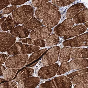 Anti-UBE3C antibody produced in rabbit, 1 X 100 µL (HPA039915-100UL)