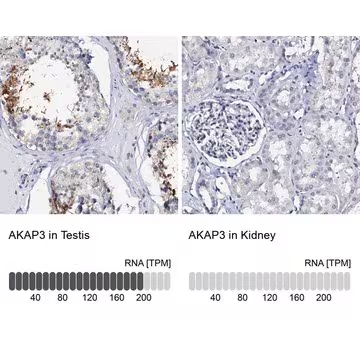 Anti-AKAP3 antibody produced in rabbit, 1 X 100 µL (HPA039765-100UL)