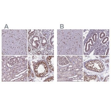 Anti-MPHOSPH8 antibody produced in rabbit, 1 X 100 µL (HPA039701-100UL)