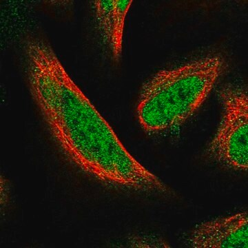 Anti-FAM107B antibody produced in rabbit, 1 X 100 µL (HPA039661-100UL)