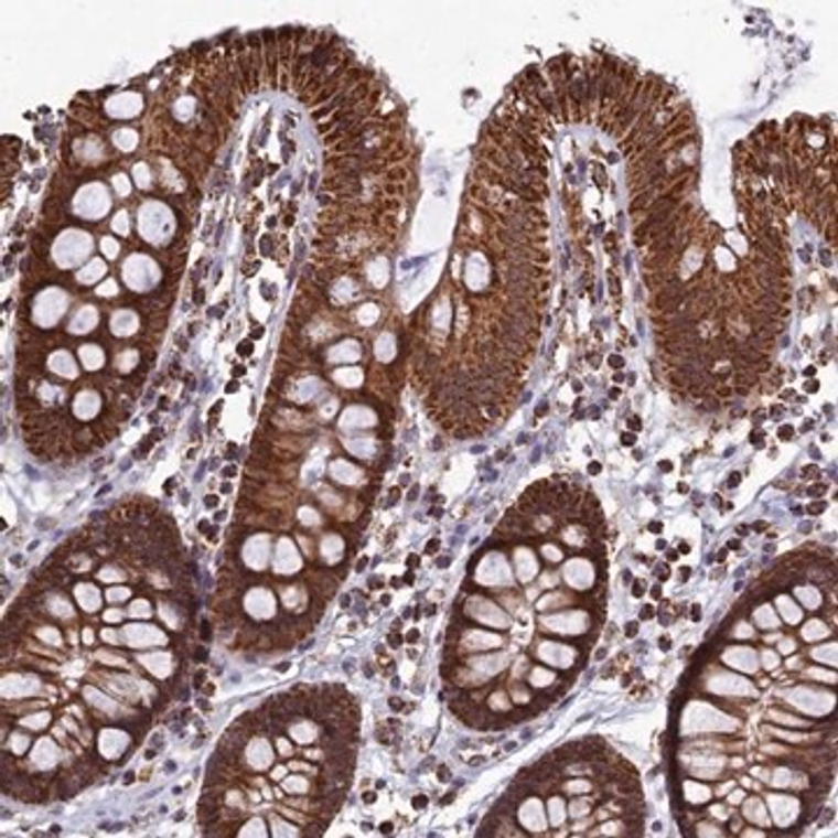 Anti-SPR antibody produced in rabbit, 1 X 100 µL (HPA039505-100UL)