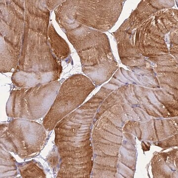 Anti-EHBP1L1 antibody produced in rabbit, 1 X 100 µL (HPA039479-100UL)