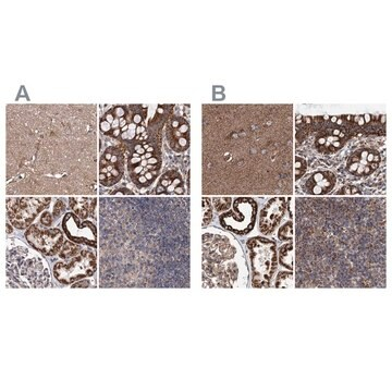 Anti-SUCLA2 antibody produced in rabbit, 1 X 100 µL (HPA039435-100UL)