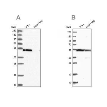 Anti-RASSF9 antibody produced in rabbit, 1 X 100 µL (HPA039428-100UL)