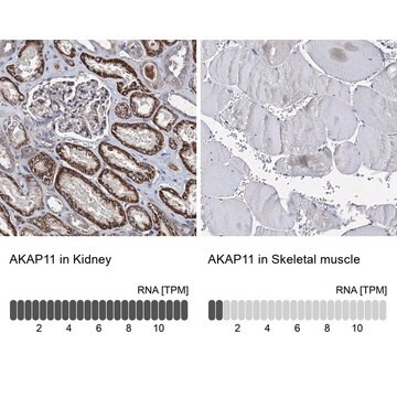 Anti-AKAP11 antibody produced in rabbit, 1 X 100 µL (HPA039089-100UL)
