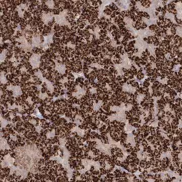 Anti-TGFBRAP1 antibody produced in rabbit, 1 X 100 µL (HPA038397-100UL)