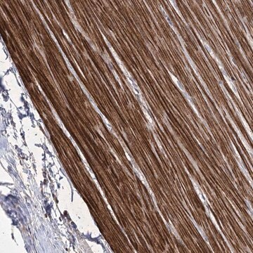 Anti-WASHC3 antibody produced in rabbit, 1 X 100 µL (HPA038338-100UL)