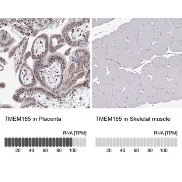Anti-TMEM165 antibody produced in rabbit, 1 X 100 µL (HPA038299-100UL)