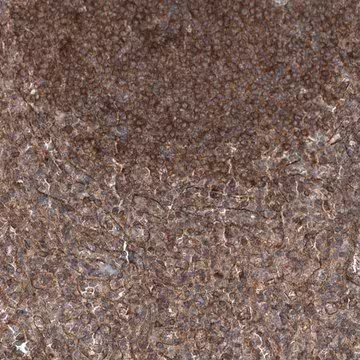 Anti-IQSEC1 antibody produced in rabbit, 1 X 100 µL (HPA038144-100UL)