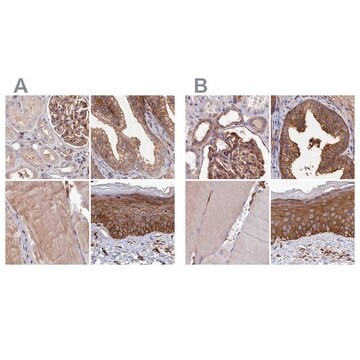Anti-TNKS1BP1 antibody produced in rabbit, 1 X 100 µL (HPA037930-100UL)