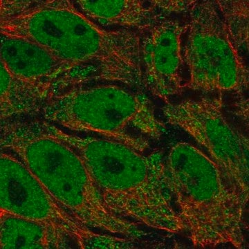 Anti-AKR1E2 antibody produced in rabbit, 100 µL (HPA037821-100UL)