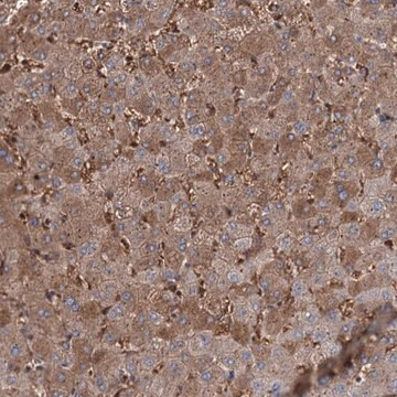 Anti-RPUSD3 antibody produced in rabbit, 1 X 100 µL (HPA037551-100UL)
