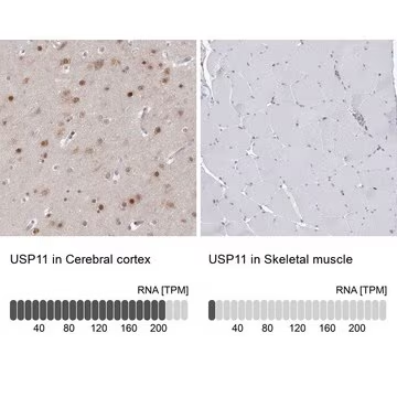 Anti-USP11 antibody produced in rabbit, 1 X 100 µL (HPA037536-100UL)