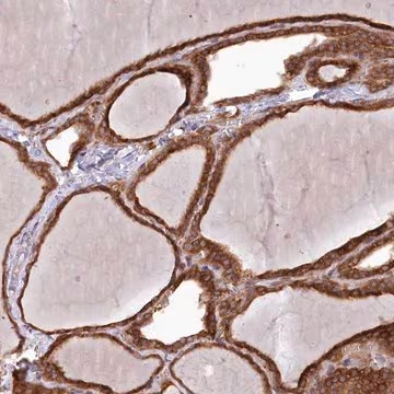 Anti-PPP1R21 antibody produced in rabbit, 1 X 100 µL (HPA036791-100UL)