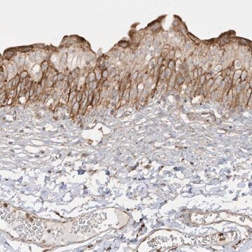 Anti-SH3BP2 antibody produced in rabbit, 1 X 100 µL (HPA036790-100UL)