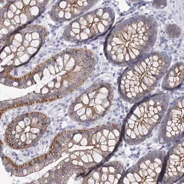 Anti-WNT8B antibody produced in rabbit, 1 X 100 µL (HPA036570-100UL)