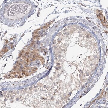 Anti-LACTB antibody produced in rabbit, 1 X 100 µL (HPA036362-100UL)