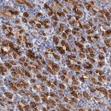 Anti-GPR155 antibody produced in rabbit, 1 X 100 µL (HPA036159-100UL)