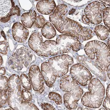 Anti-PLEKHA5 antibody produced in rabbit, 1 X 100 µL (HPA035923-100UL)