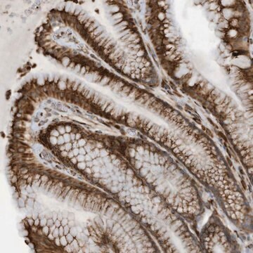 Anti-ZBTB45 antibody produced in rabbit, 1 X 100 µL (HPA035754-100UL)