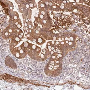 Anti-SH2D3A antibody produced in rabbit, 1 X 100 µL (HPA035722-100UL)