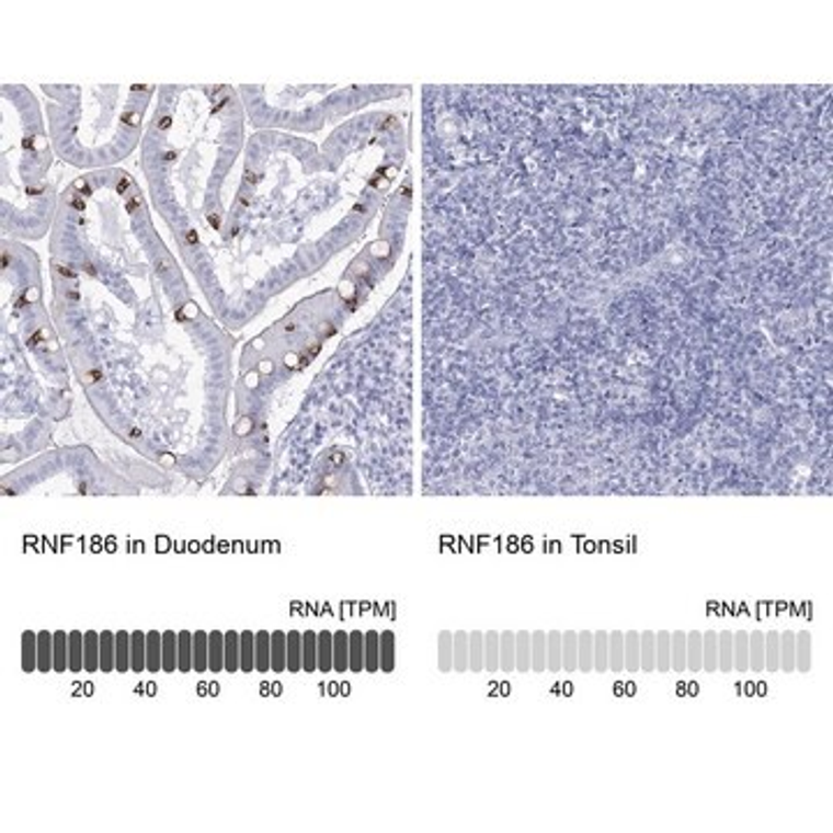 Anti-RNF186 antibody produced in rabbit, 100 µL (HPA035558-100UL)