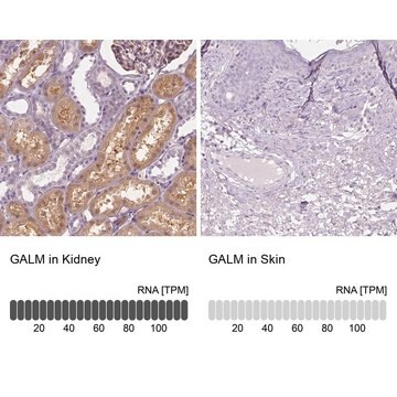 Anti-GALM antibody produced in rabbit, 100 µL (HPA035473-100UL)