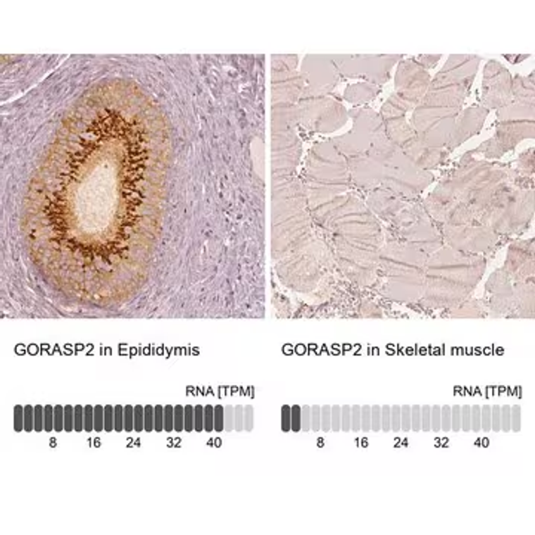 Anti-GORASP2 antibody produced in rabbit, 100 µL (HPA035274-100UL)