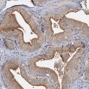 Anti-RAB17 antibody produced in rabbit, 1 X 100 µL (HPA035176-100UL)